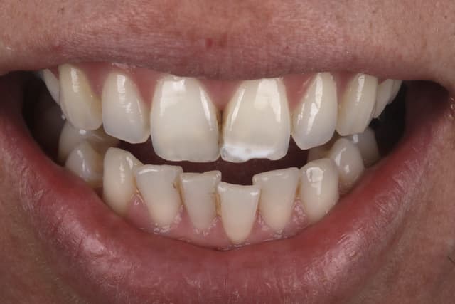 ABC Smile Makeover before