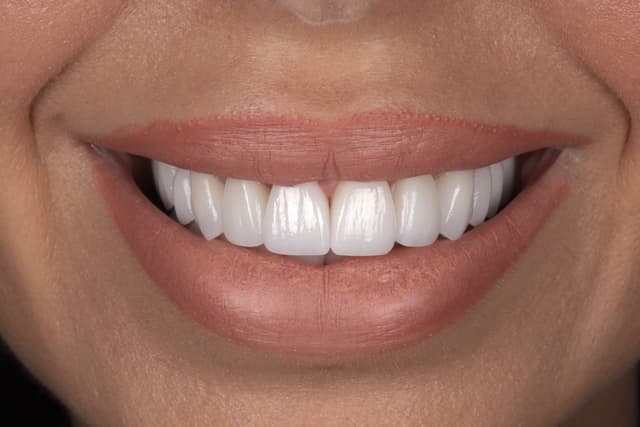 Porcelain after