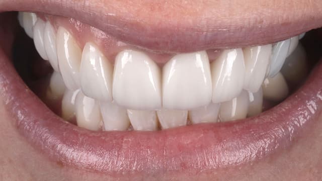 Porcelain after