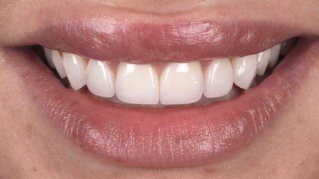 Porcelain after