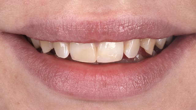 Porcelain before