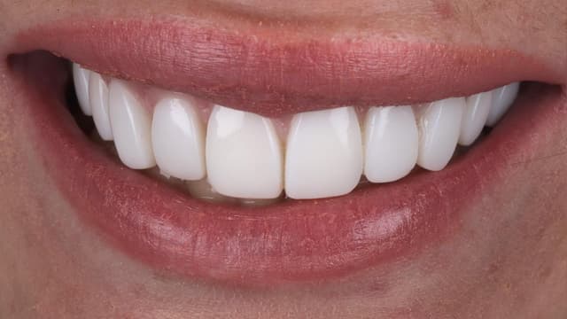 ABC Smile Makeover after