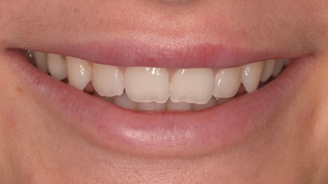 ABC Smile Makeover before