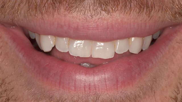 ABC Smile Makeover before