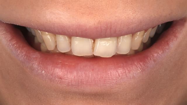 ABC Smile Makeover before